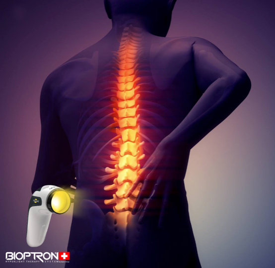 Lichttherapie bei Rückenschmerzen